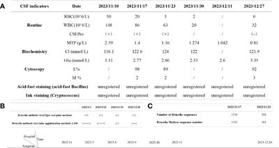 Brucellosis infection complicated with myelitis: a case report and literature review